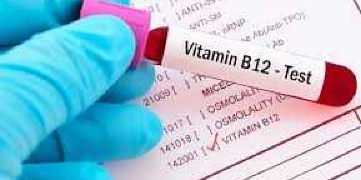 Understanding the Vitamin B12 Test Cost and Its Importance